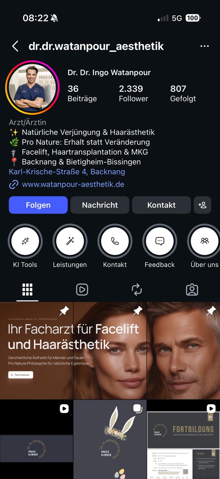 Dr. Dr. Watanpour Ästhetik Instagram, Nachher